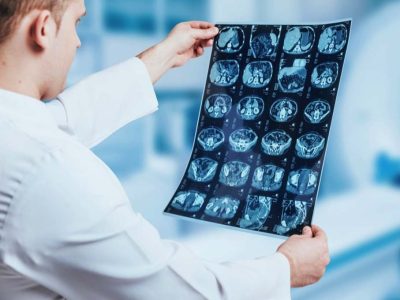 ΒΟΗΘΟΣ ΡΑΔΙΟΛΟΓΙΑΣ ΚΑΙ ΑΚΤΙΝΟΛΟΓΙΑΣ